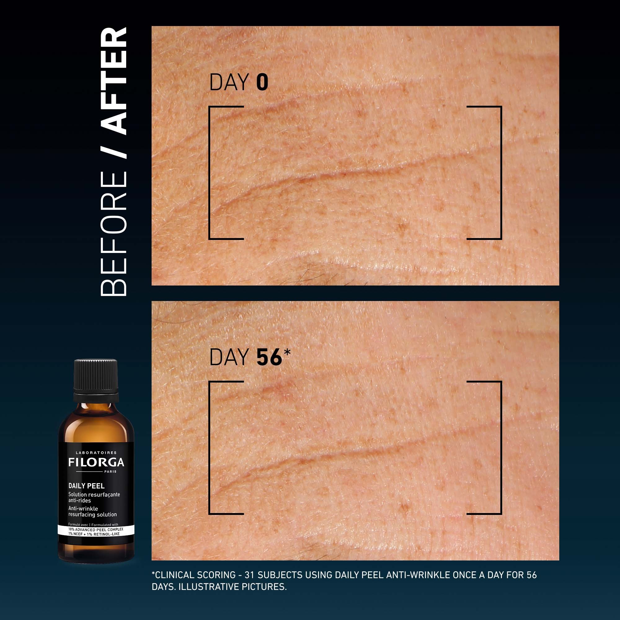 Φωτογραφία προϊόντος: Filorga Daily Peel Anti-Wrinkle Θεραπεία Κατά των Ρυτίδων